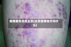 疫情紫色地区北京(北京疫情地方叫什么)