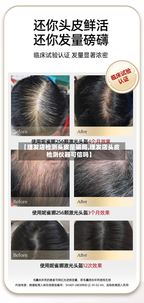 【理发店检测头皮是骗局,理发店头皮检测仪器可信吗】-第1张图片