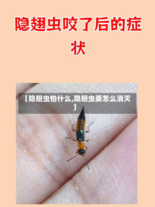 【隐翅虫怕什么,隐翅虫要怎么消灭】-第1张图片