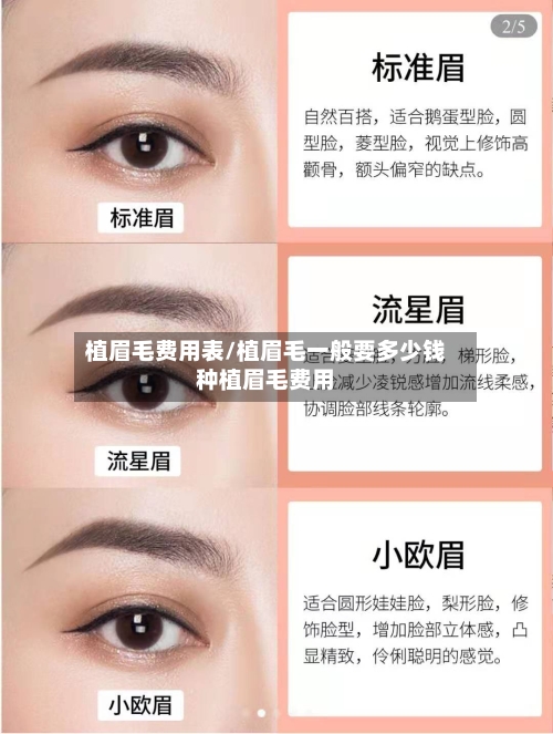 植眉毛费用表/植眉毛一般要多少钱种植眉毛费用-第1张图片