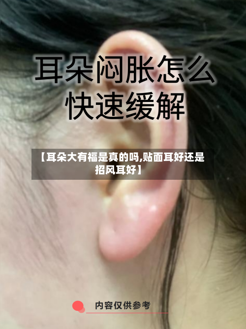 【耳朵大有福是真的吗,贴面耳好还是招风耳好】-第2张图片