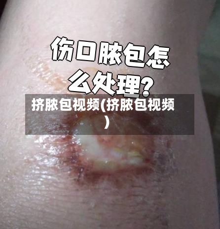 挤脓包视频(挤脓包视频)-第1张图片